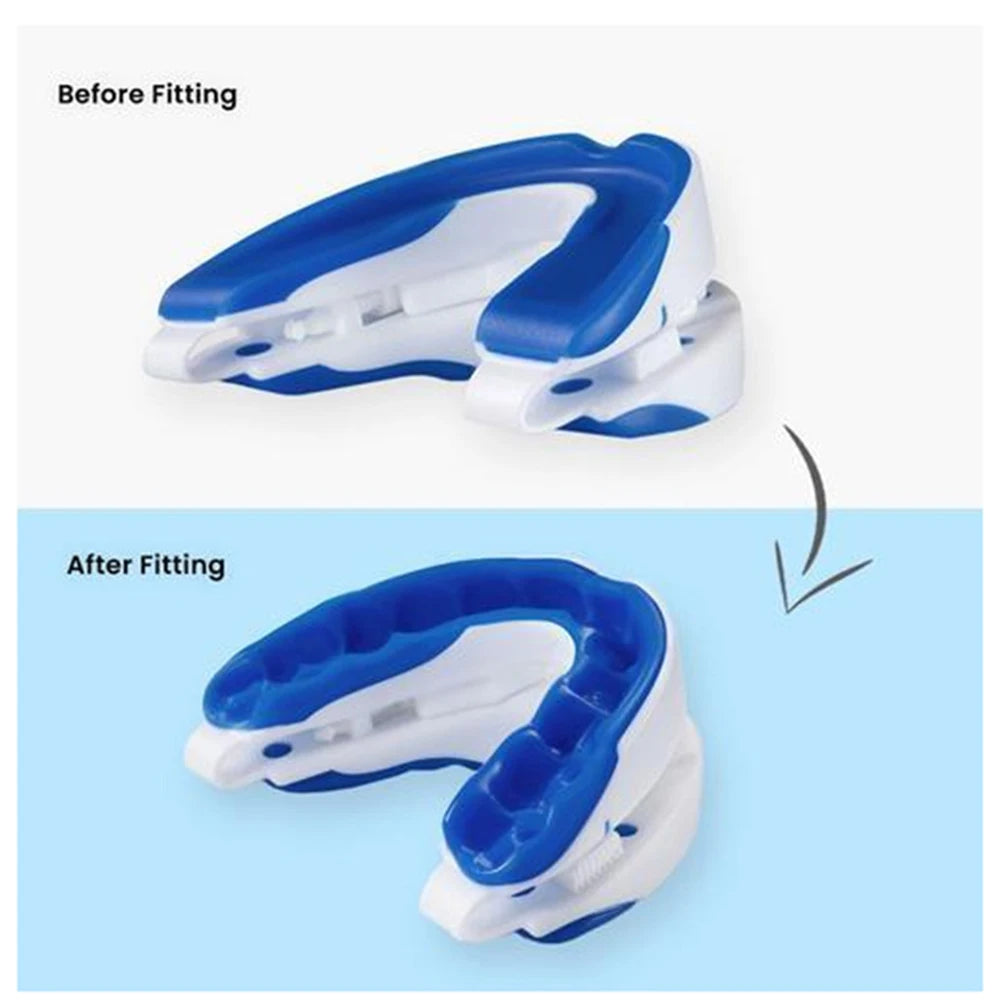 Adjustable Anti-Snoring Mouthpiece – Night Guard for Snoring and Bruxism Relief, Sleep Mouth Guard