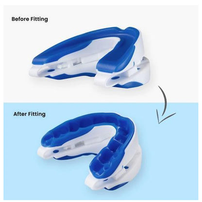 Adjustable Anti-Snoring Mouthpiece – Night Guard for Snoring and Bruxism Relief, Sleep Mouth Guard