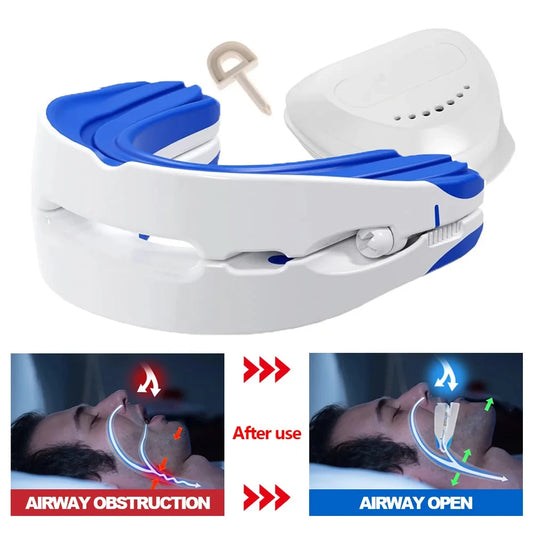 Adjustable Anti-Snoring Mouthpiece – Night Guard for Snoring and Bruxism Relief, Sleep Mouth Guard